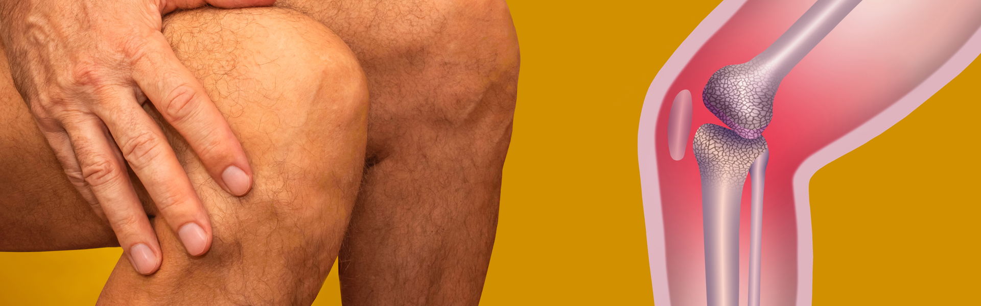 Strain-Counterstrain Positional Release Techniques for Painful Muscle Tension and Trigger Points