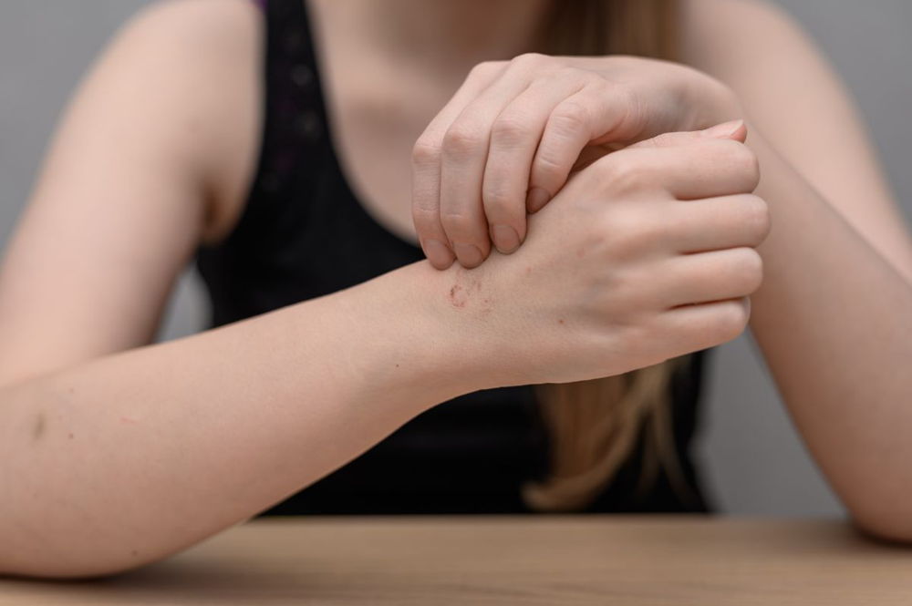 Habit Reversal Treatment for Body Focused Repetitive Movements