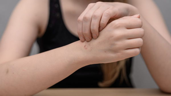 Habit Reversal Treatment for Body Focused Repetitive Movements