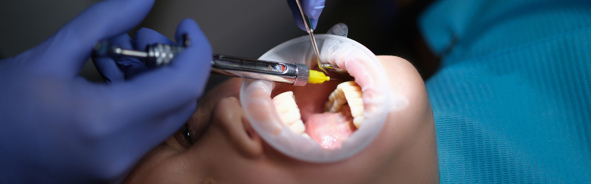 "I Have Become Profoundly Numb " - Local Anesthetics Vasoconstrictors and Clinical Dental Considerations