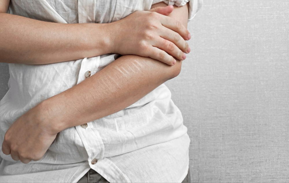 Assessing & Treating Non-Suicidal Self-Injury
