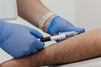 Orthobiologics Regenerative Medicine for Orthopedic Conditions