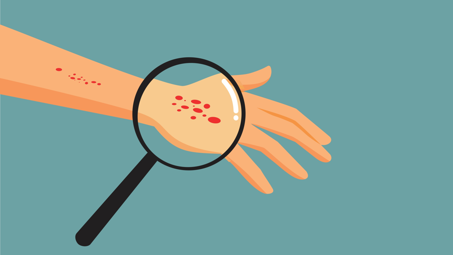 Massage Therapy and Pathology: Common and Contagious Skin Conditions